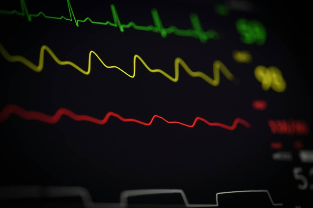 Infographic showing common pitfalls in wellness data analysis: heterogeneous formats, missing values, temporal complexity, and subjective metrics